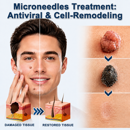 ✅🇺🇸𝐇𝐞𝒂𝒍𝗿𝗶𝙯𝙚®2-in-1 Microneedle & Hydrocolloid Patch💫| Removes Raised Moles, Acne, Flat Warts & Skin Tags | Helps Improve Wrinkles, Scars & Blemishes | Invisible Patches for Face & Body