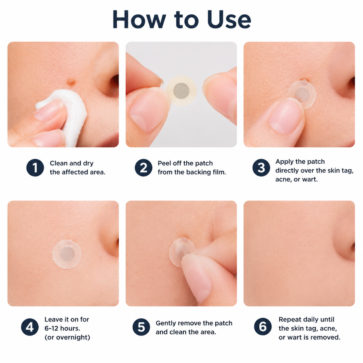 ✅🇺🇸𝐇𝐞𝒂𝒍𝗿𝗶𝙯𝙚®2-in-1 Microneedle & Hydrocolloid Patch👩‍⚕️| Removes Raised Moles, Acne, Flat Warts & Skin Tags | Helps Improve Wrinkles, Scars & Blemishes | Invisible Patches for Face & Body
