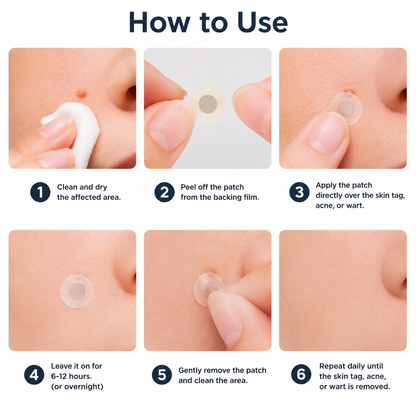 ✅🇺🇸𝐇𝐞𝒂𝒍𝗿𝗶𝙯𝙚®2-in-1 Microneedle & Hydrocolloid Patch👩‍⚕️| Removes Raised Moles, Acne, Flat Warts & Skin Tags | Helps Improve Wrinkles, Scars & Blemishes | Invisible Patches for Face & Body