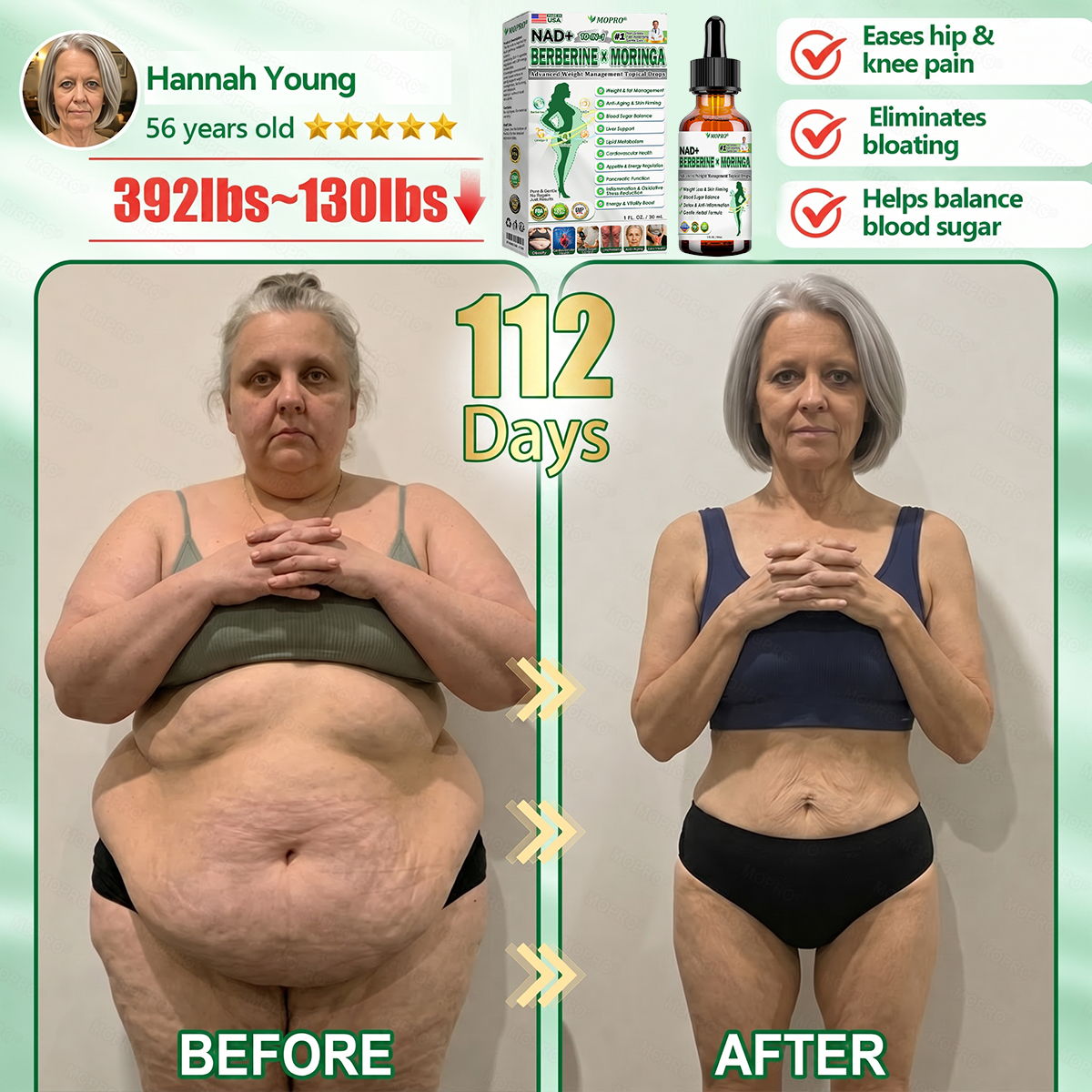 【𝟐𝟎𝟐𝟔 𝐍𝐞𝐰 𝐔𝐩𝐠𝐫𝐚𝐝𝐞: 𝟖𝟎% 𝐎𝐅𝐅】👩‍⚕️ 𝐌𝗢𝑷𝙍𝙊®𝐀𝐝𝐯𝐚𝐧𝐜𝐞𝐝 𝐖𝐞𝐢𝐠𝐡𝐭 𝐌𝐚𝐧𝐚𝐠𝐞𝐦𝐞𝐧𝐭 𝐓𝐨𝐩𝐢𝐜𝐚𝐥 𝐃𝐫𝐨𝐩𝐬 — 𝘄𝗶𝘁𝗵 𝗕𝗲𝗿𝗯𝗲𝗿𝗶𝗻𝗲 & 𝗟𝗶𝗽𝗼𝗹𝘆𝘁𝗶𝗰 𝗣𝗲𝗽𝘁𝗶𝗱𝗲 𝗖𝗼𝗺𝗽𝗹𝗲𝘅 𝗳𝗼𝗿 Detox Metabolism,𝐰𝐞𝐢𝐠𝐡𝐭 𝐦𝐚𝐧𝐚𝐠𝐞𝐦𝐞𝐧𝐭, 𝐒𝐤𝐢𝐧 𝐅𝐢𝐫𝐦𝐢𝐧𝐠,𝐛𝐥𝐨𝐨𝐝 𝐬𝐮𝐠𝐚𝐫 𝐛𝐚𝐥𝐚𝐧𝐜𝐞 & 𝐡𝐞𝐚𝐫𝐭 𝐡𝐞𝐚𝐥𝐭𝐡 𝐬𝐮𝐩𝐩𝐨𝐫𝐭