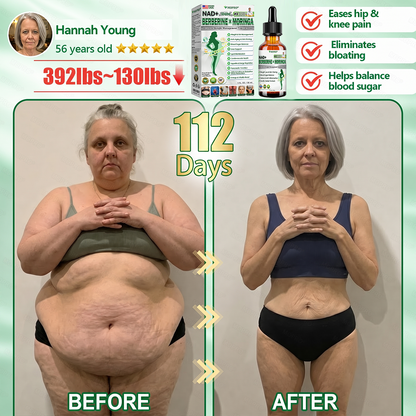 【𝟐𝟎𝟐𝟔 𝐍𝐞𝐰 𝐔𝐩𝐠𝐫𝐚𝐝𝐞: 𝟖𝟎% 𝐎𝐅𝐅】👩‍⚕️ 𝐌𝗢𝑷𝙍𝙊®𝐀𝐝𝐯𝐚𝐧𝐜𝐞𝐝 𝐖𝐞𝐢𝐠𝐡𝐭 𝐌𝐚𝐧𝐚𝐠𝐞𝐦𝐞𝐧𝐭 𝐓𝐨𝐩𝐢𝐜𝐚𝐥 𝐃𝐫𝐨𝐩𝐬 — 𝘄𝗶𝘁𝗵 𝗕𝗲𝗿𝗯𝗲𝗿𝗶𝗻𝗲 & 𝗟𝗶𝗽𝗼𝗹𝘆𝘁𝗶𝗰 𝗣𝗲𝗽𝘁𝗶𝗱𝗲 𝗖𝗼𝗺𝗽𝗹𝗲𝘅 𝗳𝗼𝗿 Detox Metabolism,𝐰𝐞𝐢𝐠𝐡𝐭 𝐦𝐚𝐧𝐚𝐠𝐞𝐦𝐞𝐧𝐭, 𝐒𝐤𝐢𝐧 𝐅𝐢𝐫𝐦𝐢𝐧𝐠,𝐛𝐥𝐨𝐨𝐝 𝐬𝐮𝐠𝐚𝐫 𝐛𝐚𝐥𝐚𝐧𝐜𝐞 & 𝐡𝐞𝐚𝐫𝐭 𝐡𝐞𝐚𝐥𝐭𝐡 𝐬𝐮𝐩𝐩𝐨𝐫𝐭