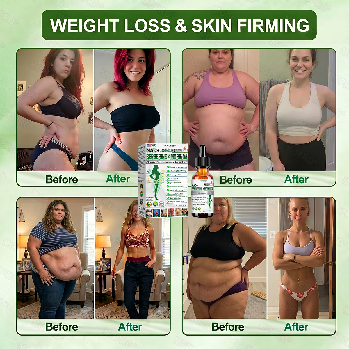【𝟐𝟎𝟐𝟔 𝐍𝐞𝐰 𝐔𝐩𝐠𝐫𝐚𝐝𝐞: 𝟖𝟎% 𝐎𝐅𝐅】👩‍⚕️ 𝐌𝗢𝑷𝙍𝙊®𝐀𝐝𝐯𝐚𝐧𝐜𝐞𝐝 𝐖𝐞𝐢𝐠𝐡𝐭 𝐌𝐚𝐧𝐚𝐠𝐞𝐦𝐞𝐧𝐭 𝐓𝐨𝐩𝐢𝐜𝐚𝐥 𝐃𝐫𝐨𝐩𝐬 — 𝘄𝗶𝘁𝗵 𝗕𝗲𝗿𝗯𝗲𝗿𝗶𝗻𝗲 & 𝗟𝗶𝗽𝗼𝗹𝘆𝘁𝗶𝗰 𝗣𝗲𝗽𝘁𝗶𝗱𝗲 𝗖𝗼𝗺𝗽𝗹𝗲𝘅 𝗳𝗼𝗿 Detox Metabolism,𝐰𝐞𝐢𝐠𝐡𝐭 𝐦𝐚𝐧𝐚𝐠𝐞𝐦𝐞𝐧𝐭, 𝐒𝐤𝐢𝐧 𝐅𝐢𝐫𝐦𝐢𝐧𝐠,𝐛𝐥𝐨𝐨𝐝 𝐬𝐮𝐠𝐚𝐫 𝐛𝐚𝐥𝐚𝐧𝐜𝐞 & 𝐡𝐞𝐚𝐫𝐭 𝐡𝐞𝐚𝐥𝐭𝐡 𝐬𝐮𝐩𝐩𝐨𝐫𝐭